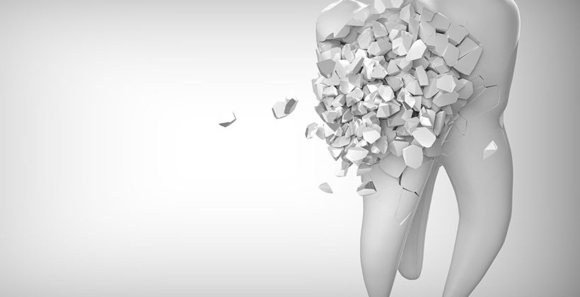 Uzroci pretjerane osjetljivosti zubi