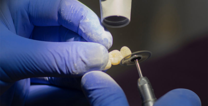 Dentalna protetika – sve što trebate znati