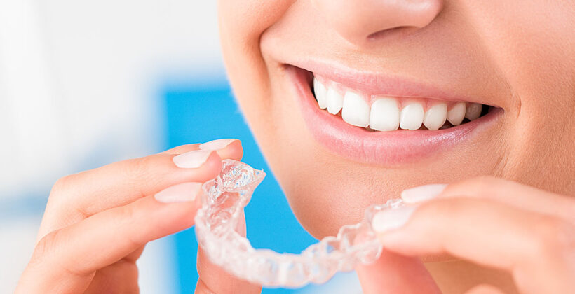 Udlaga za zube – kada se koristi i koliko nam pomaže