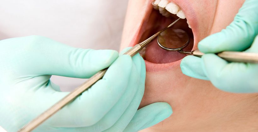 Dental Masnić leksikon: Apsces Zuba i Ankilozirani Zub