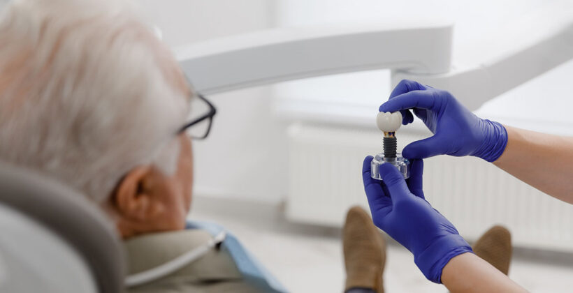 Idealni kandidati za ugradnju zubnog implantata