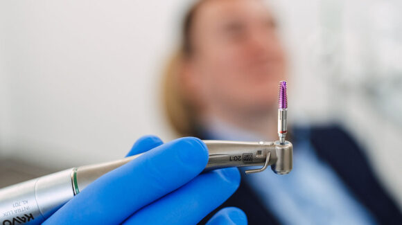 Ugradnja implantata: što je mit, a što istina?