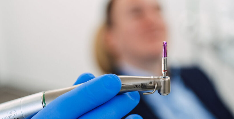 Ugradnja implantata: što je mit, a što istina?